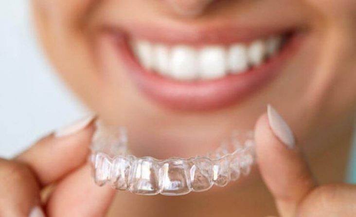 Fogszabályozás ThermalDent Sárvár